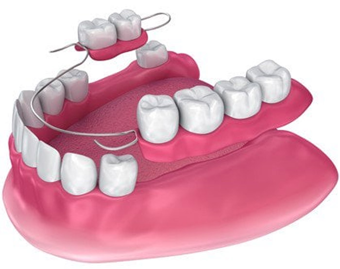 Dentures Grandville Mi Dentists